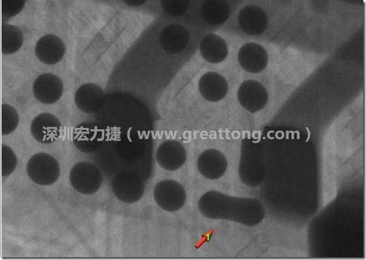 BGA因為焊墊變小，造成錫膏過多而最終形成焊接短路的結(jié)果。